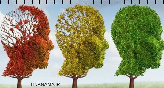 روش جدید تشخیص آلزایمر